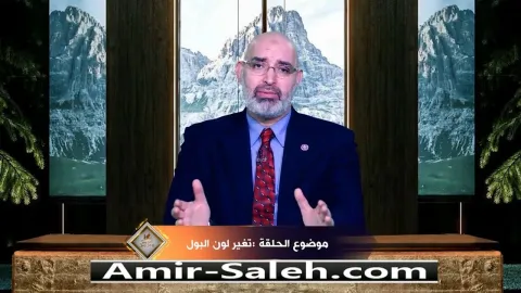 تغير لون البول  | برنامج عرض ومرض