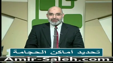 تحديد أماكن الحجامة  | الطب الآمن