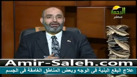 علاج البقع البنية فى الوجه وبعض المناطق الغامقة فى الجسم
