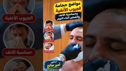 مواضع حجامة الجيوب الأنفية وحساسية الانف والشخير أثناء النوم